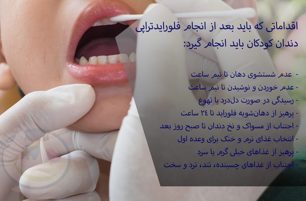 اقدامات بعد از فلورایدتراپی دندان کودکان