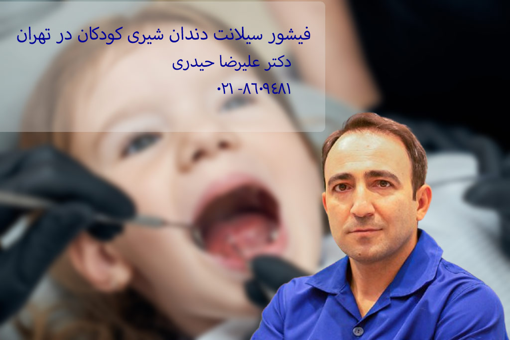 فیشور سیلانت دندان شیری کودکان توسط دکتر حیدری