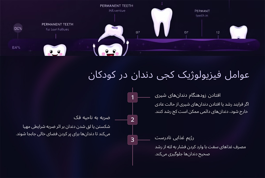 عوامل فیزیولوژیک کجی دندان در کودکان 