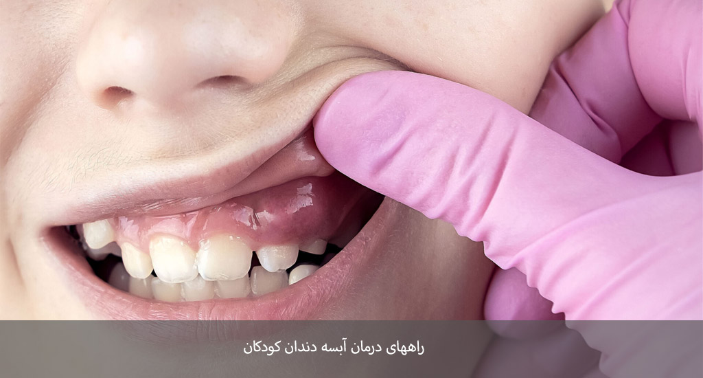 راههای درمان آبسه دندان کودکان